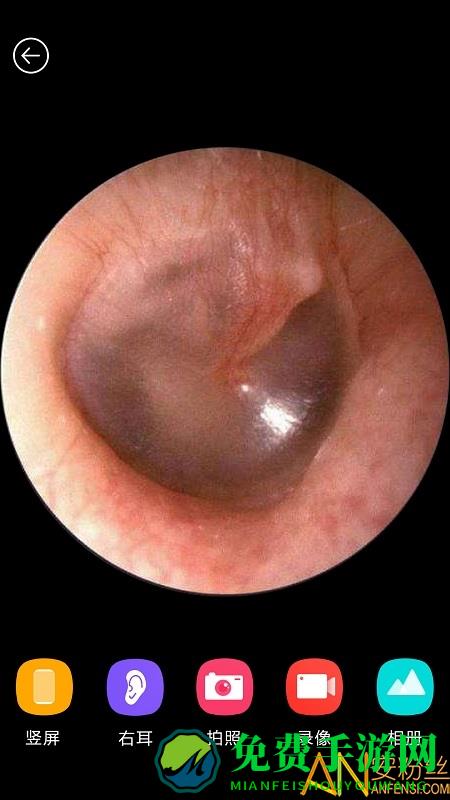 蜂鸟采耳app(bebird)