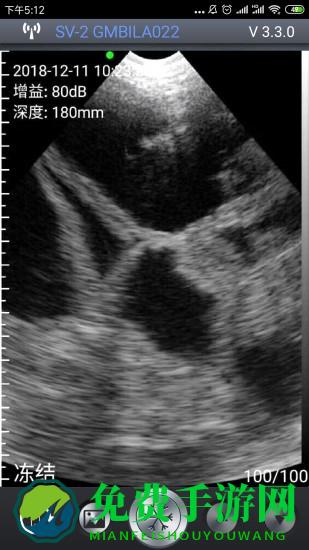 智能B超官方版下载
