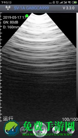智能B超app手机版